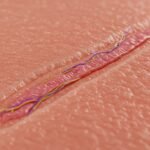 Como o corpo humano se regenera curiosidades sobre cicatrização